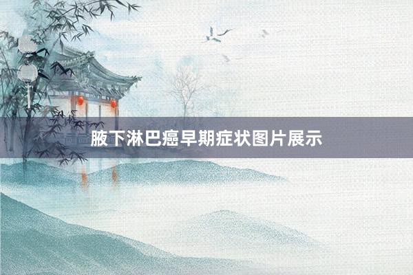腋下淋巴癌早期症状图片展示